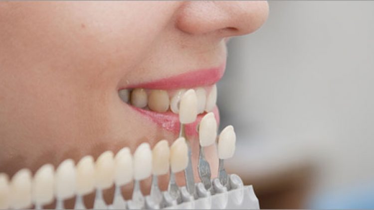 A woman testing her teeth sample
